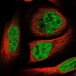 HOXC5 Antibody, Novus Biologicals 25 &mu;L; Unlabeled:Antibodies, Polyclonal